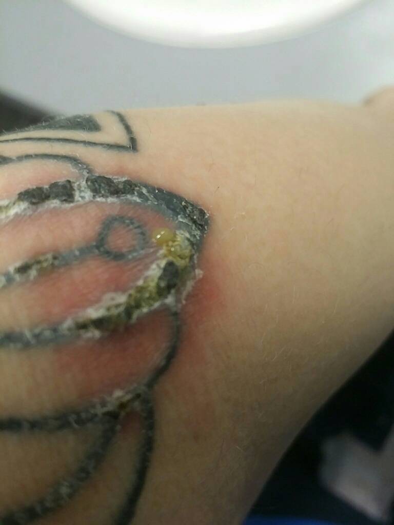 Is It Normal For My Tattoo To Scab  Stories and Ink