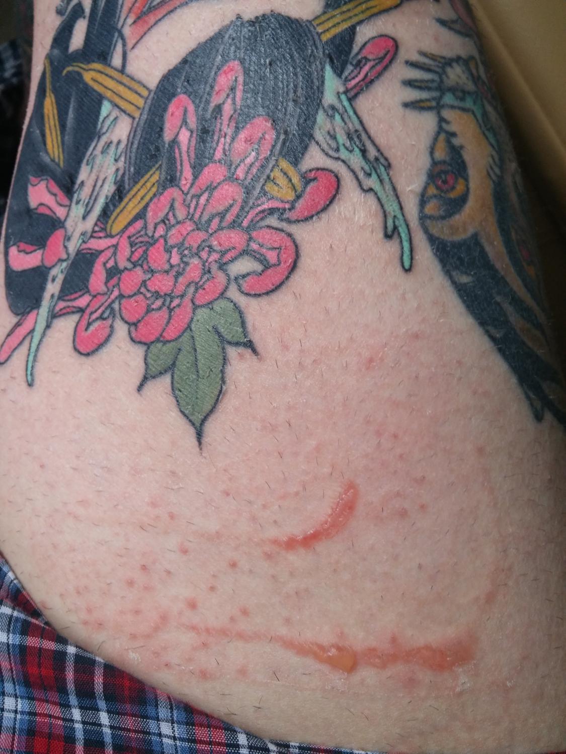 Tattoos and Eczema Can Coexist Tattooing Tips If You Have Eczema