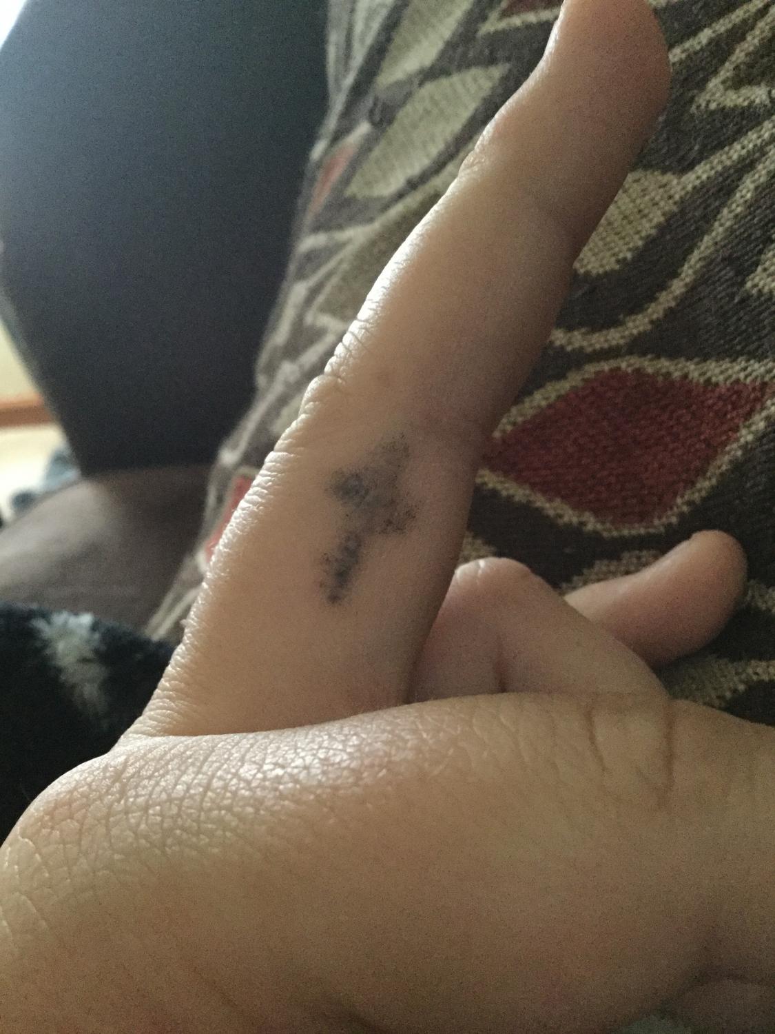 What to Do When Tattoo Is Peeling and the Ink Is Coming Off Before and  After   Saved Tattoo