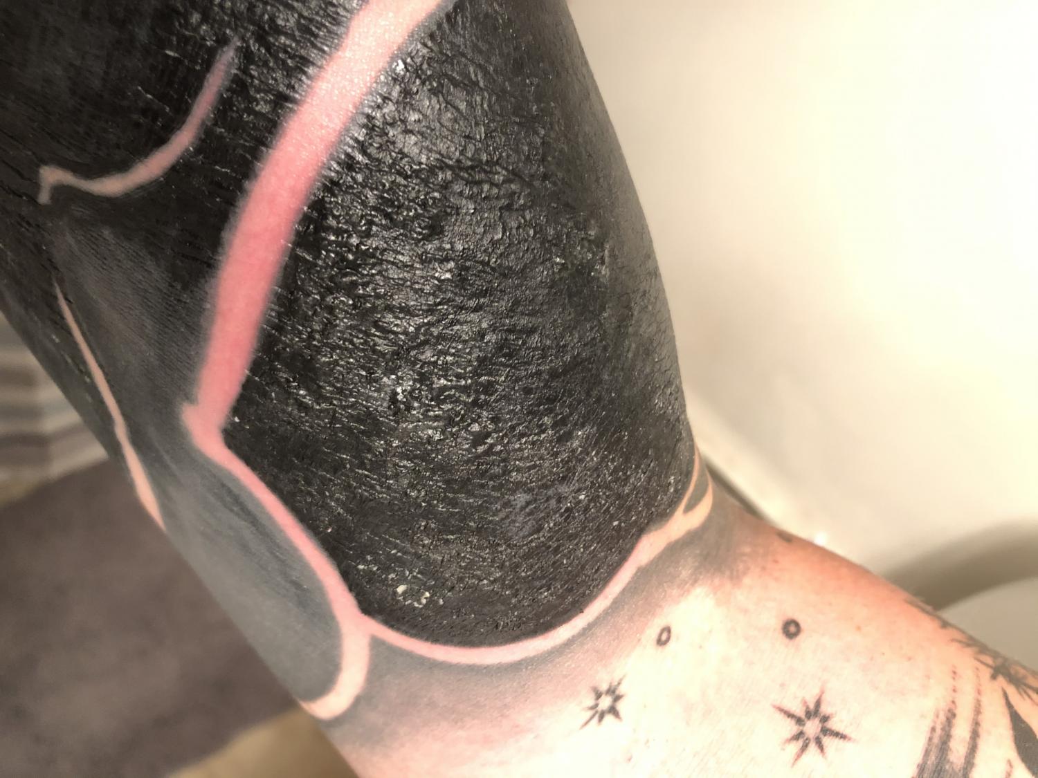 Tattoo infection or rough healing The larger red part of where I took the  saniderm off so Im not too worried about that Im referring to the ditch  and the small red