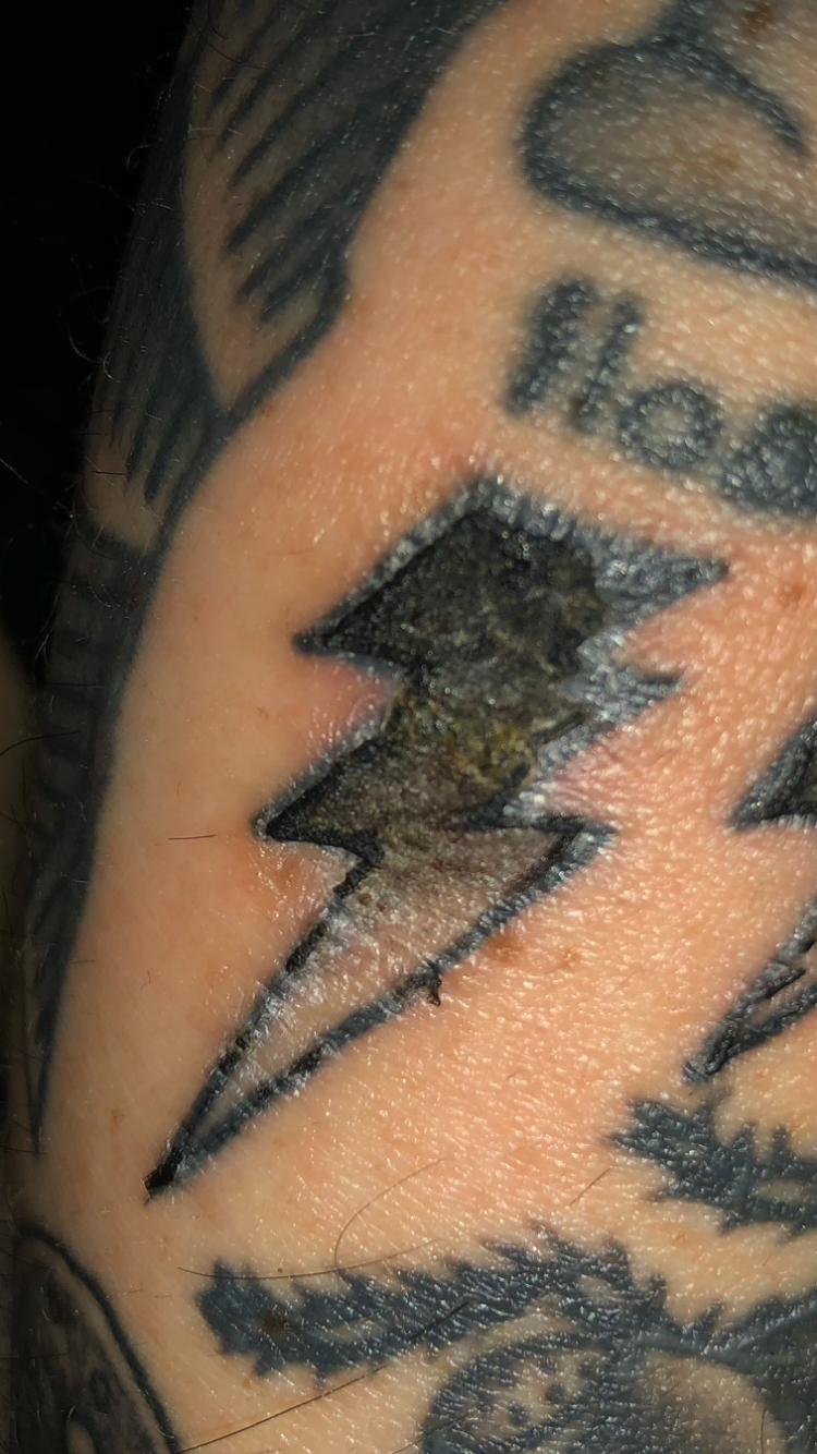 Tattoo Scab or Scar How to Tell if Your Tattoo is Healing Properly   Dermeleve